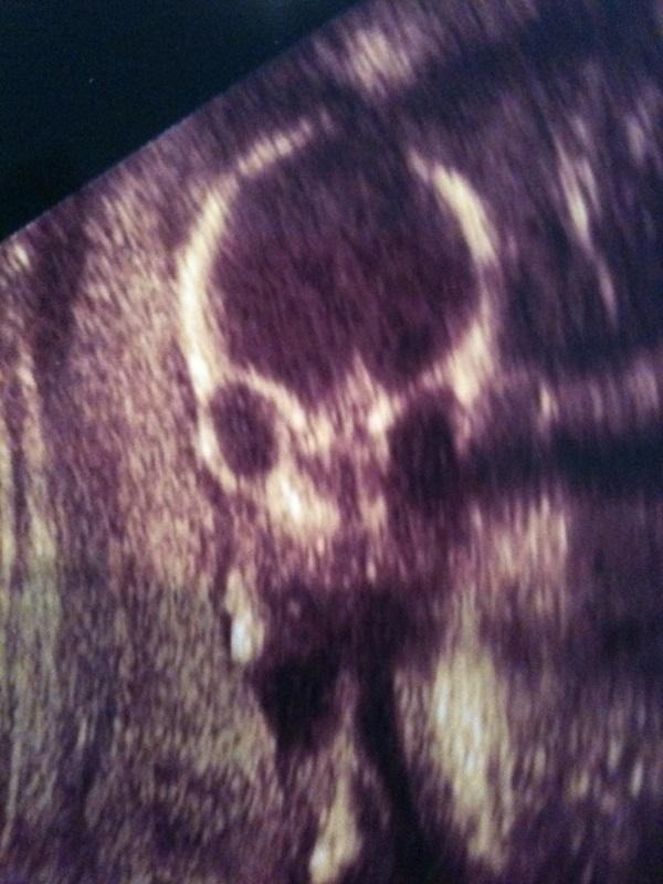 This woman is about to birth the Grim Reaper.