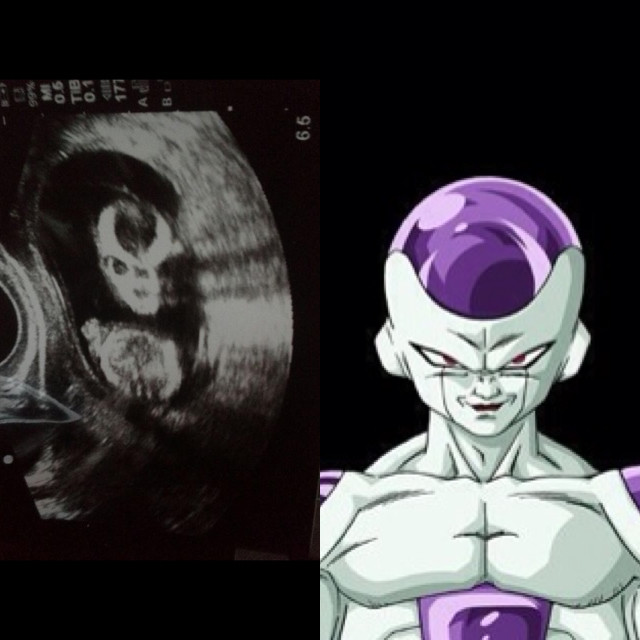 Goku...I hope you