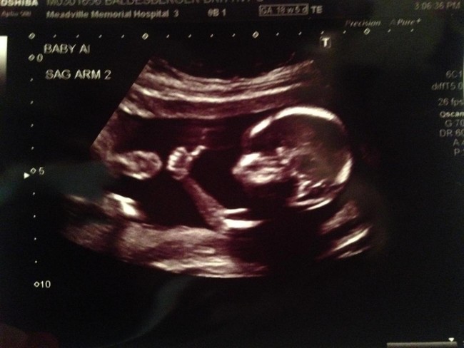 Thumbs up!