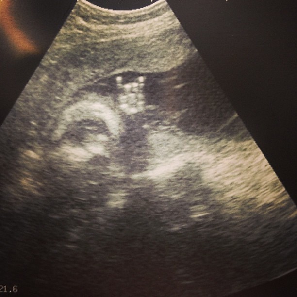 Rock on, little dude. Rock on.